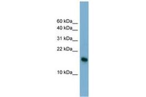 Image no. 1 for anti-Basic Leucine Zipper Transcriptional Factor ATF-Like 3 (BATF3) (N-Term) antibody (ABIN6741959)
