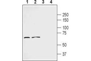 Western blot analysis of human MDA-231 breast carcinoma cell line lysate (lanes 1 and 3) and human THP-1 acute monocytic leukemia cell line lysate (lanes 2 and 4): - 1,2. (FZD2 anticorps  (Extracellular, N-Term))