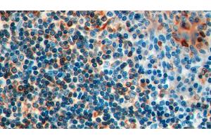 Detection of CD74 in Human Tonsil Tissue using Polyclonal Antibody to Cluster Of Differentiation 74 (CD74)