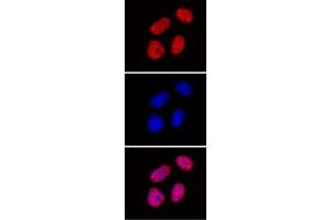 Histone H3 di/trimethyl Lys27 antibody (mAb) tested by immunofluorescence. (Histone 3 anticorps  (H3K27me2, H3K27me3))