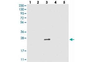 Western blot analysis of Lane 1: RT-4, Lane 2: U-251 MG, Lane 3: Human Plasma, Lane 4: Liver, Lane 5: Tonsil with VSTM2A polyclonal antibody . (VSTM2A anticorps)