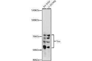 Western blot analysis of extracts of various cell lines, using Tau antibody (ABIN3021441, ABIN3021442, ABIN3021443 and ABIN6215045) at 1:500 dilution. (MAPT anticorps  (AA 1-100))