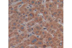 Used in DAB staining on fromalin fixed paraffin- embedded Kidney tissue (MMP21 anticorps  (AA 335-547))