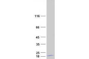 Validation with Western Blot