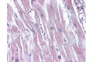 IHC-P Image Immunohistochemical analysis of paraffin-embedded human heart, using Arp2, antibody(10 μg/ml). (ACTR2 anticorps)