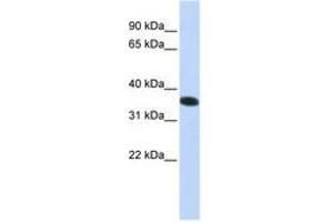 Image no. 1 for anti-Chromosome 21 Open Reading Frame 59 (C21orf59) (N-Term) antibody (ABIN6740941) (C21orf59 anticorps  (N-Term))