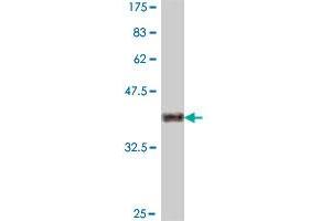 Western Blot detection against Immunogen (37.