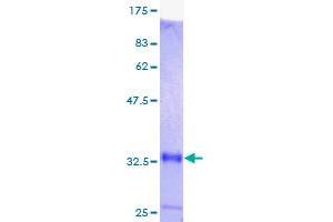 Metallothionein 1M (MT1M) (AA 1-61) protein (GST tag)