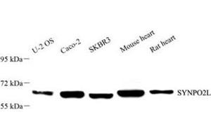 Western blot analysis of SYNPO2L (ABIN7075791) at dilution of 1: 2000 (SYNPO2L anticorps)
