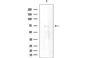 Western blot analysis of lysates from EC304 cells(heat-shock treatment), using SYTL4 Antibody at 1/1000 dilution.