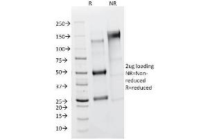 SDS-PAGE Analysis Purified FSH Receptor Mouse Monoclonal Antibody (FSHR/1400). (FSHR anticorps)
