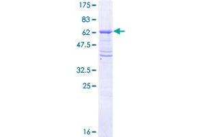 Image no. 1 for Transforming Growth Factor, beta Receptor II (70/80kDa) (TGFBR2) (AA 1-334) protein (GST tag) (ABIN1322611)