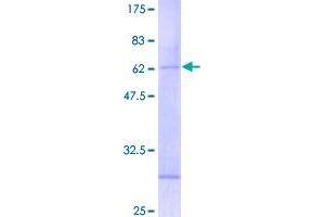 Image no. 1 for Ring Finger Protein 32 (RNF32) (AA 1-235) protein (GST tag) (ABIN1318369)
