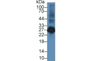 Detection of LAT2 in Rat Spleen lysate using Polyclonal Antibody to Linker For Activation Of T-Cells Family, Member 2 (LAT2)
