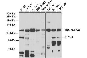 Western blot analysis of extracts of various cell lines, using CLCN7 antibody (ABIN6133268, ABIN6138670, ABIN6138672 and ABIN6222613) at 1:1000 dilution.