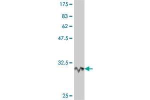 anti-UNQ1887 (AA 212-262) antibody