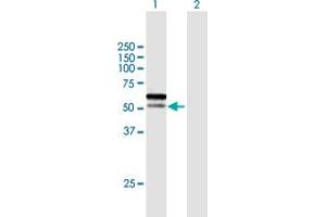 Western Blot analysis of C1orf124 expression in transfected 293T cell line by C1orf124 MaxPab polyclonal antibody. (Spartan anticorps  (AA 1-489))
