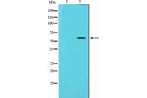 Western blot analysis of Chk1 phosphorylation expression in UV treated HT29 whole cell lysates,The lane on the left is treated with the antigen-specific peptide. (CHEK1 anticorps  (pSer280))