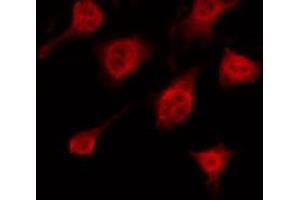 ABIN6266577 staining HeLa by IF/ICC. (Keratin 10 anticorps  (Internal Region))
