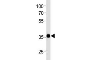 Western blot analysis of lysate from NCCIT cell line using SOX2 antibody at 1:1000. (SOX2 anticorps  (N-Term))