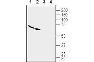 Western blot analysis of human U-87 MG glioblastoma cell line lysate (lanes 1 and 3) and human Malme-3M melanoma cell line lysate (lanes 2 and 4): - 1,2. (TNFRSF19 anticorps  (Extracellular, N-Term))