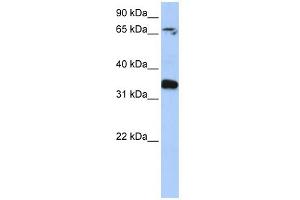 WB Suggested Anti-GLE1 Antibody Titration: 0.