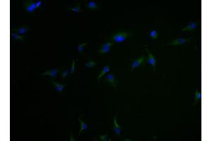 Immunofluorescence staining of Hela cells with ABIN7147892 at 1:100, counter-stained with DAPI. (Claudin 18 anticorps  (AA 196-261))