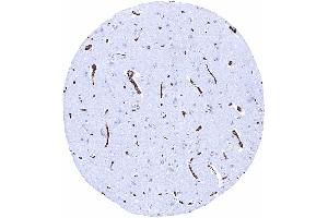 Cerebrum grey matter A particularly strong GLUT1 staining of endothelial cells is seen in the brain