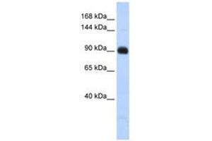 Image no. 1 for anti-Matrilin 2 (MATN2) (AA 791-840) antibody (ABIN6741404) (MATN2 anticorps  (AA 791-840))