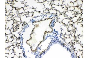 IHC analysis of Periostin using anti-Periostin antibody .