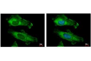 ICC/IF Image RPS10 antibody detects RPS10 protein at cytoplasm by immunofluorescent analysis. (RPS10 anticorps)