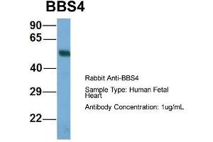 Host: Rabbit  Target Name: BBS4  Sample Tissue: Human Fetal Heart  Antibody Dilution: 1. (BBS4 anticorps  (N-Term))