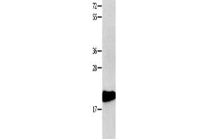 Gel: 10+12 % SDS-PAGE, Lysate: 40 μg, Lane: 231 cells, Primary antibody: ABIN7190308(CMTM3 Antibody) at dilution 1/350, Secondary antibody: Goat anti rabbit IgG at 1/8000 dilution, Exposure time: 1 minute (CMTM3 anticorps)