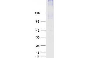 Validation with Western Blot