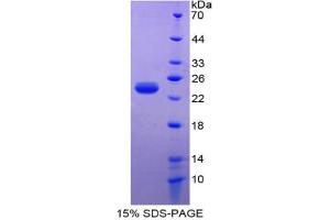 SDS-PAGE analysis of Mouse PARK7 Protein. (PARK7/DJ1 Protéine)