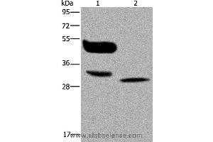 Western blot analysis of A375 cell and human lung cancer tissue, using MAGEA8 Polyclonal Antibody at dilution of 1:400 (MAGEA8 anticorps)