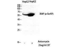 Western Blotting (WB) image for anti-X-Linked Inhibitor of Apoptosis (XIAP) (pSer87) antibody (ABIN3173245) (XIAP anticorps  (pSer87))