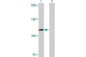 anti-Microtubule Associated Monoxygenase, Calponin and LIM Domain Containing 1 (MICAL1) (AA 1-981) antibody