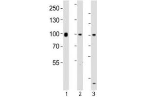 Western blot testing of Suz12 antibody at 1:1000 dilution. (SUZ12 anticorps  (AA 496-530))