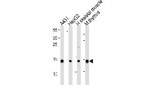 Western blot analysis of lysates from A431, HepG2 cell line, human skeletal muscle and mouse thymus tissue lysate(from left to right), using hUBE2D1-I126 at 1:1000 at each lane.