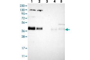Western blot analysis of Lane 1: RT-4, Lane 2: U-251 MG, Lane 3: Human Plasma, Lane 4: Liver, Lane 5: Tonsil with ZFPL1 polyclonal antibody  at 1:250-1:500 dilution. (ZFPL1 anticorps)