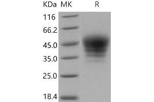 Western Blotting (WB) image for SLAM Family Member 7 (SLAMF7) (Active) protein (His tag) (ABIN7320369)