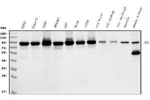 Western blot analysis of DDX1 using anti-DDX1 antibody (ABIN7602052).