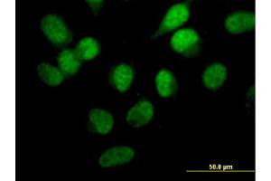 Immunofluorescence of monoclonal antibody to STK33 on HeLa cell.