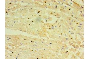 Immunohistochemistry of paraffin-embedded human heart tissue using ABIN7151238 at dilution of 1:100 (TRIM11 anticorps  (AA 267-468))