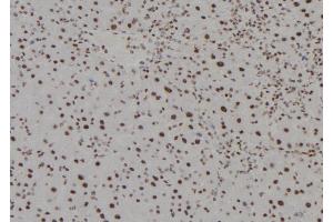 ABIN6279494 at 1/100 staining Mouse liver tissue by IHC-P. (HOXC13 anticorps  (C-Term))
