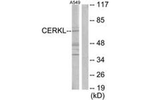 Western blot analysis of extracts from A549 cells, using CERKL Antibody. (CERKL anticorps  (AA 341-390))