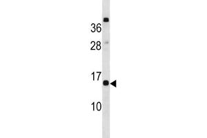 Western Blotting (WB) image for anti-C-Type Lectin Domain Family 19, Member A (CLEC19A) antibody (ABIN3004543) (CLEC19A anticorps)