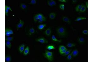 Immunofluorescent analysis of MCF-7 cells using ABIN7171879 at dilution of 1:100 and Alexa Fluor 488-congugated AffiniPure Goat Anti-Rabbit IgG(H+L) (Tetraspanin 5 anticorps  (AA 114-232))