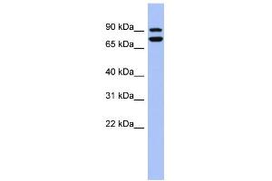 WB Suggested Anti-SOX6 Antibody Titration:  0. (SOX6 anticorps  (Middle Region))